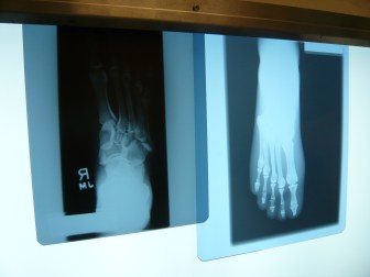 Photo by Robot B via Flickr Creative Commons